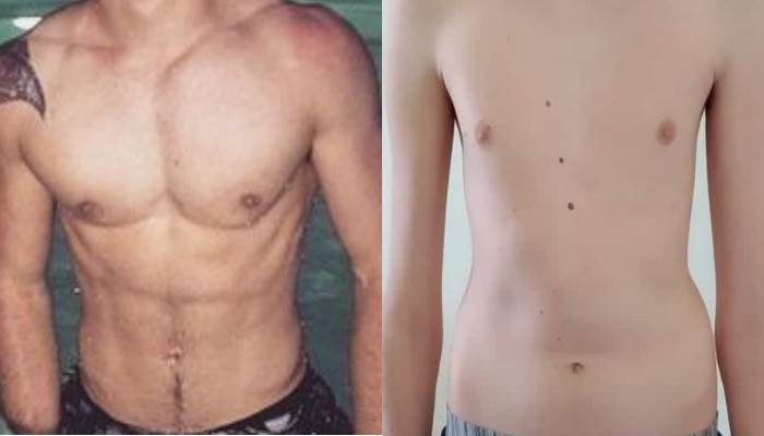 Diet and Training for Ectomorphs